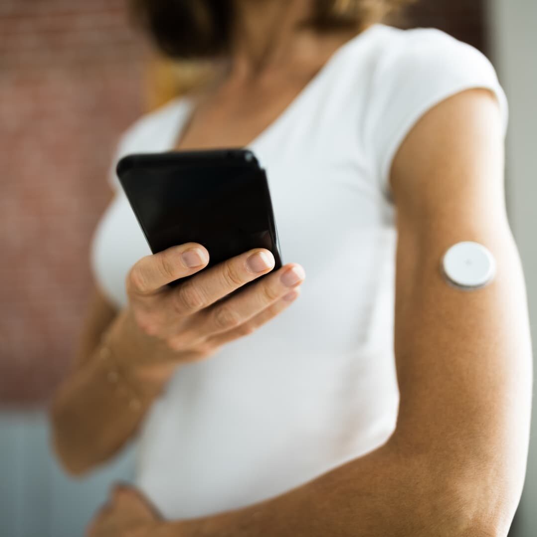 continuous glucose monitors