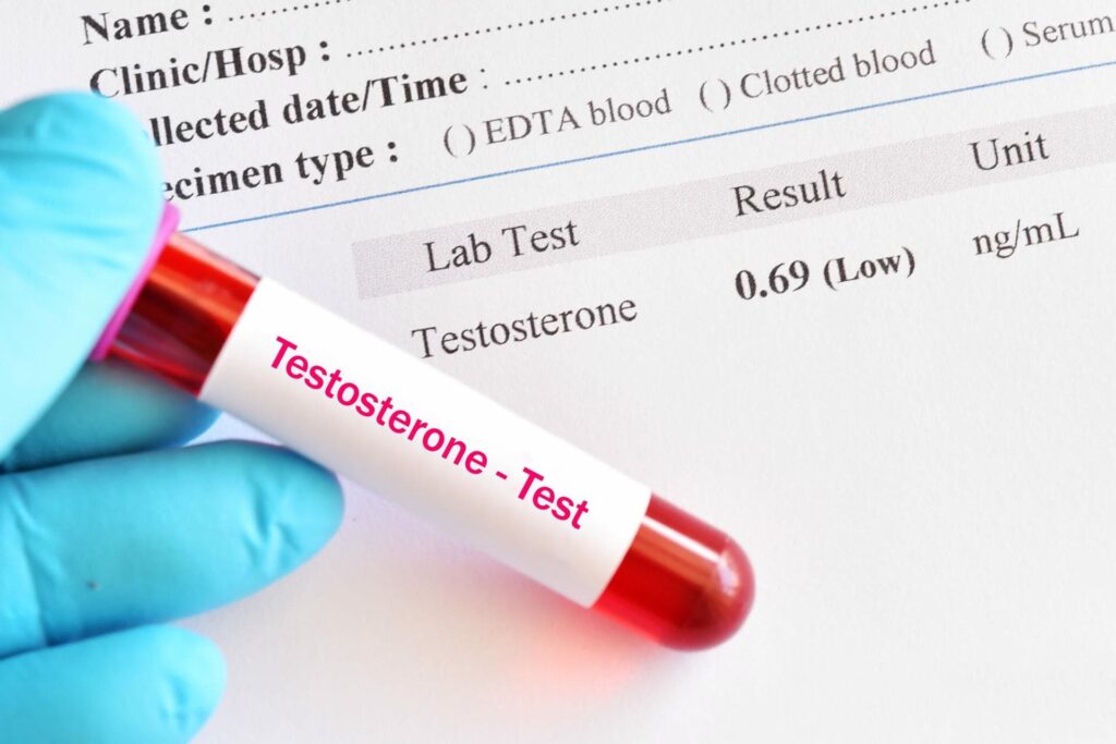 vial depicting a testosterone test